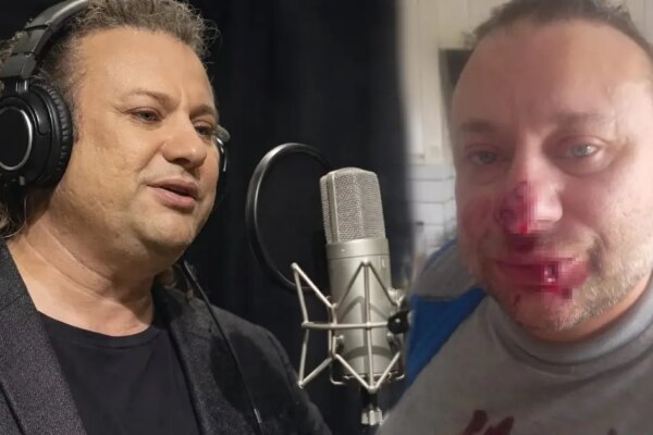 Ünlü sanatçı et yiyen bakteriyle savaşıyor