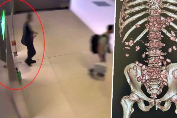 İstanbul Havalimanı’nda yürümekte zorlanan yolcu polisi alarma geçirdi. Gerçek hastanede ortaya çıktı